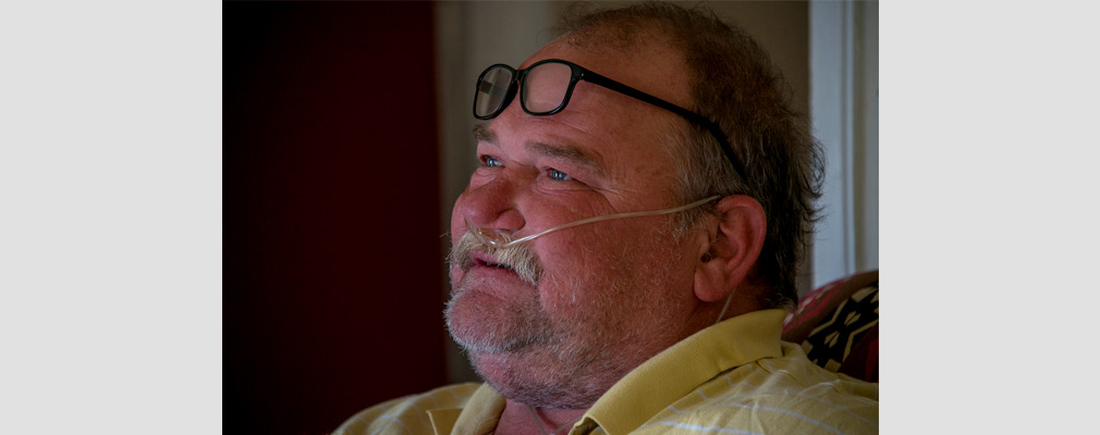 Photograph of a man with a nasal cannula.